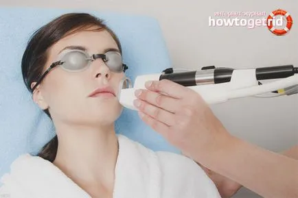 Hogyan lehet megszabadulni a seprűvénák az arcon