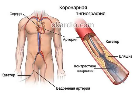 Hogyan lehet ellenőrizni a vérerek az egész test ultrahang és angiográfia, amikor meg kell tenni (ellenőrzés) Hogyan lehet ellenőrizni a vérerek az egész test ultrahang és angiográfia, amikor meg kell tenni