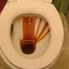 Hogyan lehet eltávolítani egy követ a WC kezével (távolítsa el a kő WC) Hogyan lehet eltávolítani egy követ a WC kezével