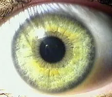 Tanuló a szem - a szerkezet és a funkció, diagnózis és a betegség - helyszíni - Moszkva Ophthalmology (funkció) Tanuló a szem - a szerkezet és a funkció, a diagnózis és a betegség - site - Moszkva Szemészet