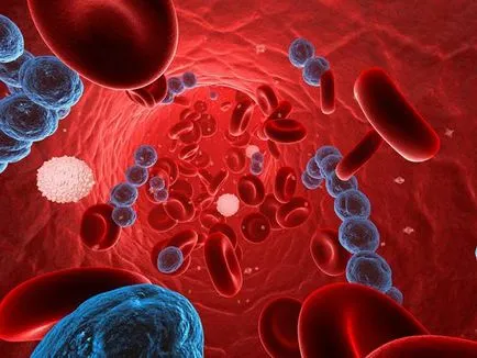 Staphylococcus aureus a kezelt felnőtt fotó fertőzések, hatékony rendszerek és kezelési módszerek