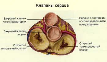 Szelepek, szelep-betegség, mitrális, szív (szelepek) Szelepek, szelep-betegség, mitrális, szív