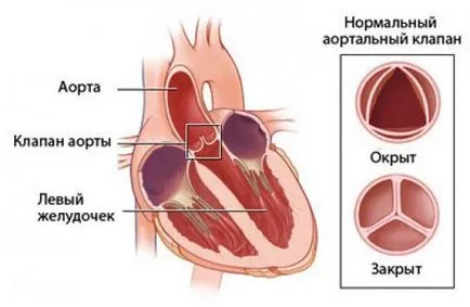 Szelepek, szelep-betegség, mitrális, szív (szelepek) Szelepek, szelep-betegség, mitrális, szív