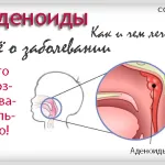Kötőhártyagyulladás felnőttek és gyerekek - hogyan kell gyógyítani betegség népi jogorvoslati (gyermek) Kötőhártyagyulladás felnőttek és gyerekek - hogyan kell gyógyítani betegség népi jogorvoslati