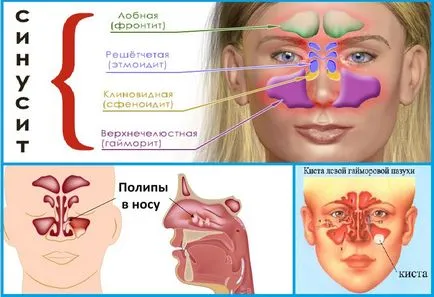 A komputertomográfia (CT), az orr és az orrmelléküregek ár, fotó, videó