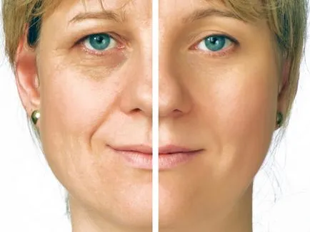 Kozmetika lamerel véleménye, ár, kozmetika lamerel (Beauty) Kozmetika lamerel véleménye, ár, lamerel kozmetika