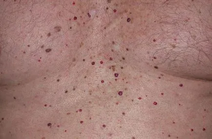 Red mol a test okok