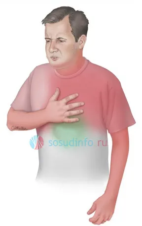 Kisebb szív tünetei kezelés
