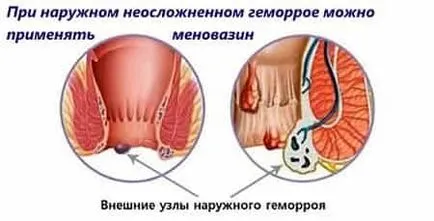 Menovazin amit segít - Menovazin otthoni használatra (segítség) Menovazin amit segít - Menovazin otthoni használatra