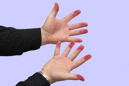 Néhány tipp, hogyan mossa el fukortsin (öblítés) Néhány tipp, hogyan mossa el fukortsin