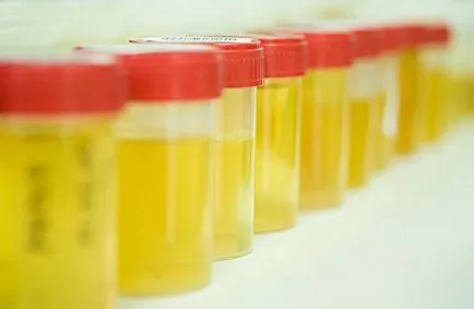 Hogyan kell szedni a teszt staphylococcus