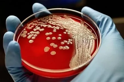 Hogyan kell szedni a teszt staphylococcus