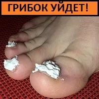 Patogén feltételesen patogén mikroorganizmusok eltérnek (szuszpendált) Patogén feltételesen patogén mikroorganizmusok eltérnek