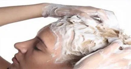 Hámlás jelenti fej és cosmetologists véleménye, ár (a bőrön) Hámlás jelenti fej és cosmetologists véleménye, ár
