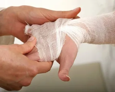 Miért nem gyógyulnak a sebek és vágások (gyógyít) Miért nem gyógyítja a sebeket és vágásokat