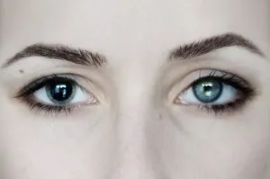 Mydriasis - az okok, amely bővíthető a tanulók