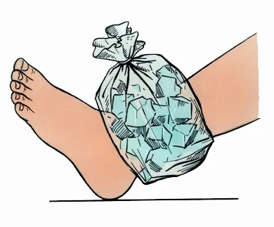 Rándulások - Causes, tünetek és kezelés (ficam) Rándulások - okai, tünetei és kezelése
