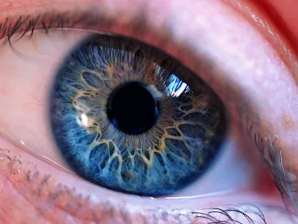 Mydriasis - az okok, amely bővíthető a tanulók