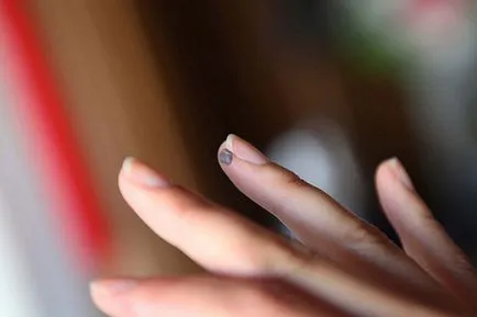 Anyajegy ujján - gyűrű, index, közepes, magas, jobb és bal oldali, az értéke
