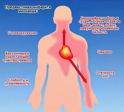 Szívroham okoz, tünetei, és mit kell tenni kezelés () Egy szívroham okoz, tünetei, kezelése és mit kell tenni