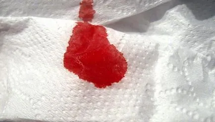 Mennyi vért egy nő elveszíti a menstruáció alatt, és hol vannak az áramlás a menstruáció
