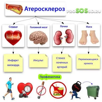Agyi érrendszeri Genesis kezelés
