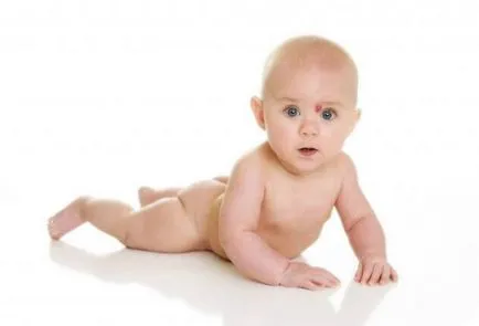 Removal hemangioma gyermek lézer működését más módszerekkel (lézer) Removal hemangioma gyermek lézer, más működési módszerek