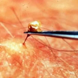 Méh csípése (fotó), az elsősegély, a tünetek és a kezelés