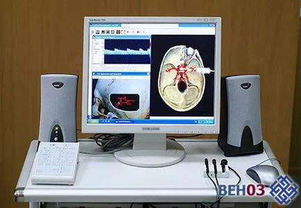 Uzi hajók a nyak és a fej mit ultrahang a fej (fejbőr) Uzi hajók a nyak és a fej, ami ultrahangfej