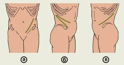 Retroperitoneum - ez