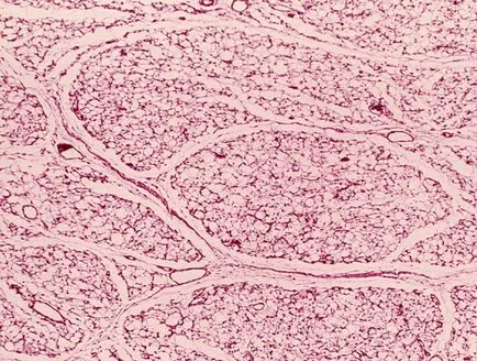Retroperitoneum - ez