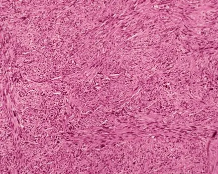 Retroperitoneum - ez