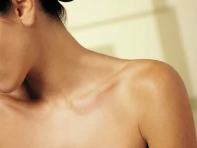 Összeesküvés psoriasis eljárás