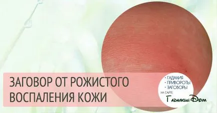 Parcellák, hogyan kell gyógyítani a betegséget orbánc hagyományos módszerek