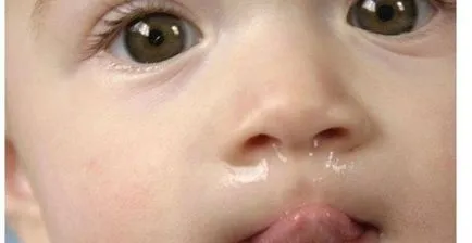 Aspirator Baba nazális aspirators típusai és felhasználási feltételek (a szabályok szerint) Aspirator Baba nazális aspirators típusai és felhasználási feltételek