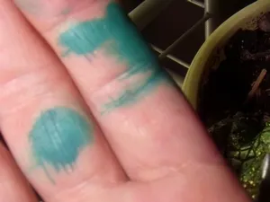 A mosási Zelenka a bőrt, mint a bozót foltokat a kéz, arc, test