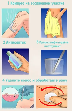 láb gyantázás otthon -, hogyan kell csinálni