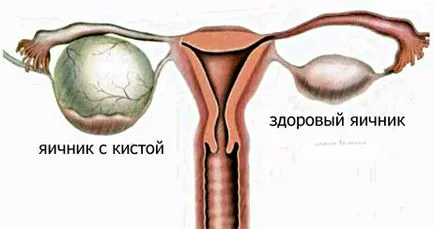 Nőgyógyászati ​​betegségek listája a legáltalánosabb