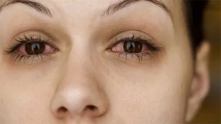 Eye tetraciklin kenőcs - használati utasítás