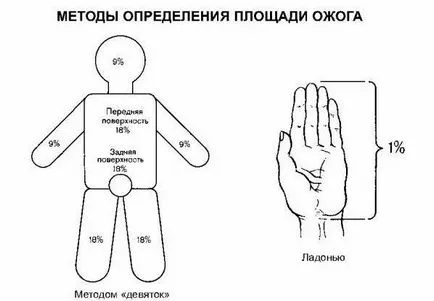 Amíg gyógyítani égési sérülések 1, 2, 3, 4 fok
