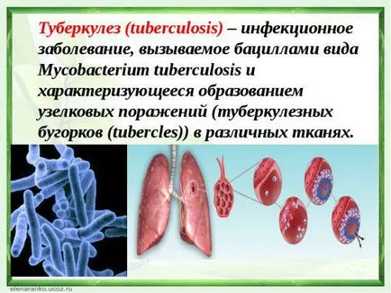 Hogyan kell kezelni tüdőbajban az otthoni emberek jogorvoslatok, gyógyszer, előírások, a felnőttek (tüdő) Hogyan kell kezelni tüdőbajban az otthoni emberek jogorvoslatok, gyógyszer, előírások, felnőttek
