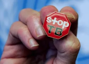 Hogyan lehet azonosítani a tuberkulózis otthon az első jelei és tünetei