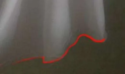 Hogyan kell felhívni a ceruza redők elemzést a nagy hibákat példáján