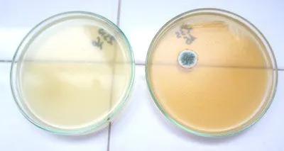 Hogyan sterilizálja eszközök otthon