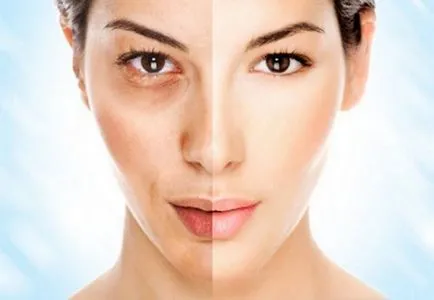 photoaging meg