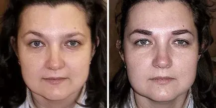 Hogyan összeszedi a szemöldökét, otthon és menet helyesen és szépen
