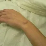 Hydroma mi ez