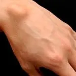 Hydroma mi ez