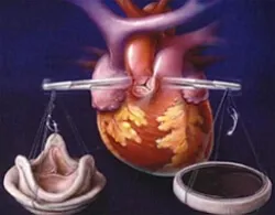 hypovolemia meg