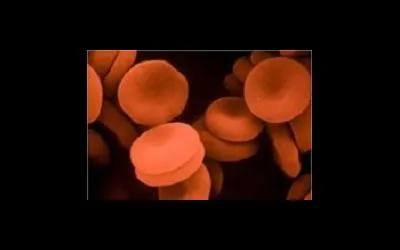 hypovolemia meg